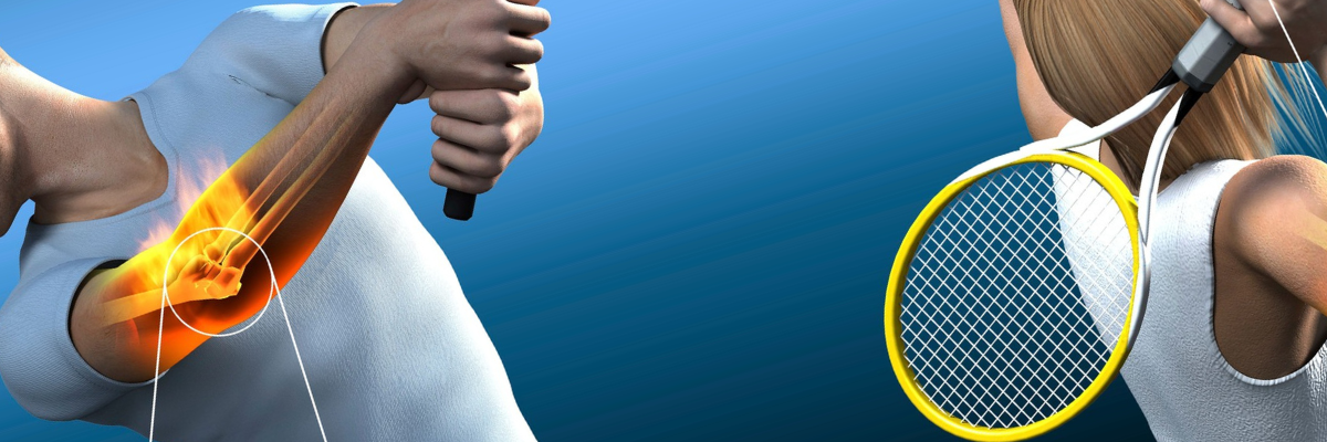 Terapia manual para aliviar las tensiones en el codo de tenista